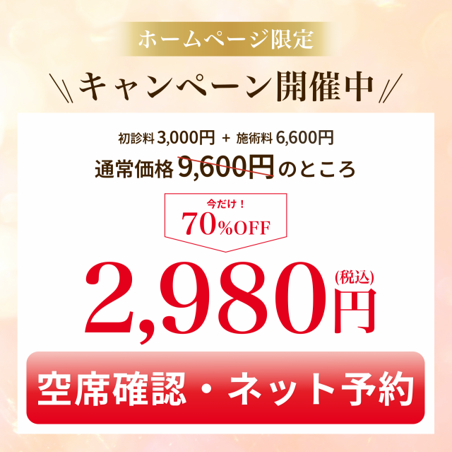 オファー