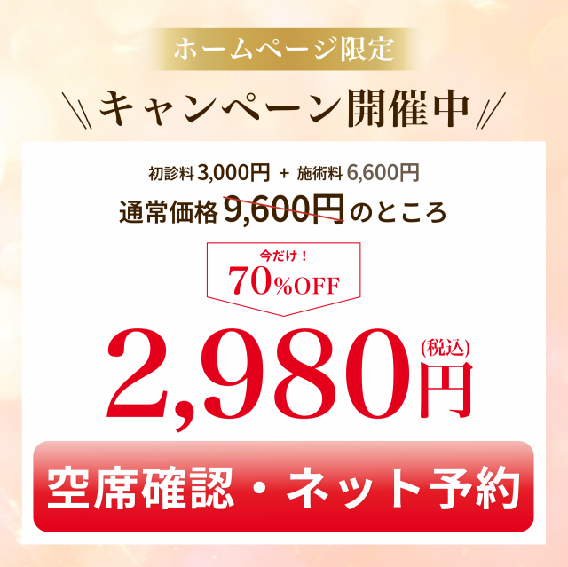 オファー