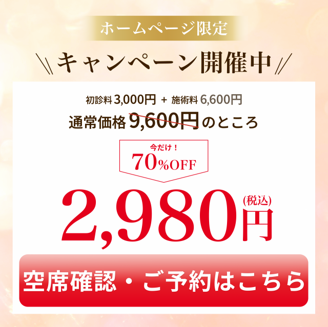 オファー