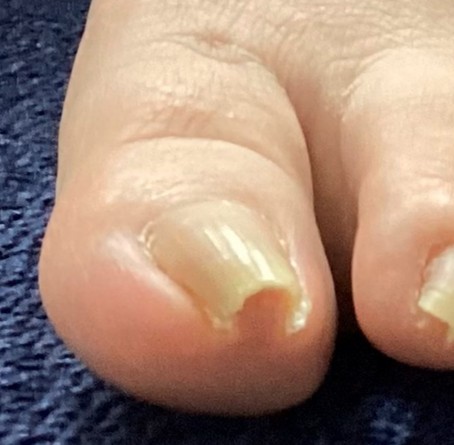 before画像