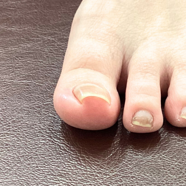 before画像