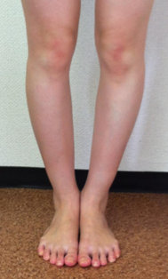 before画像