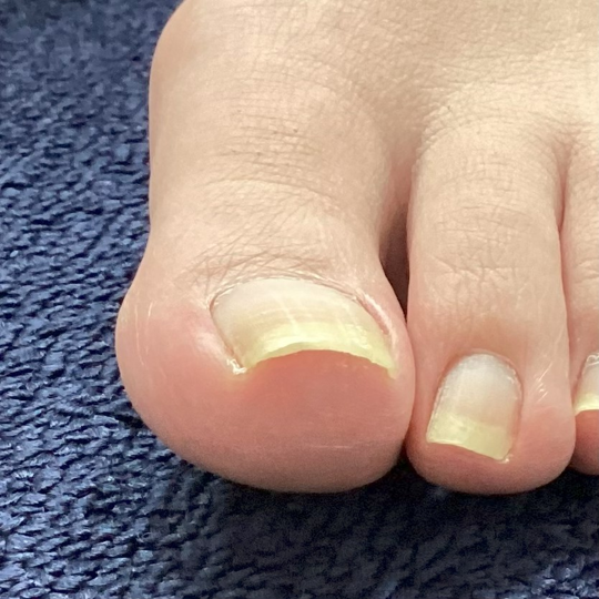 before画像