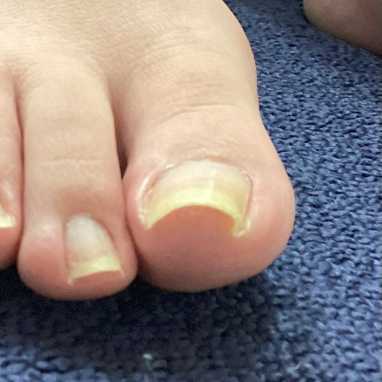 before画像
