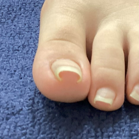before画像