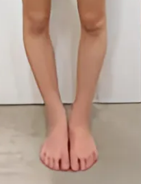 before画像