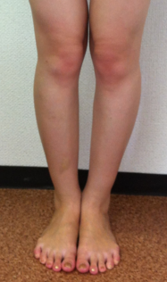 after画像