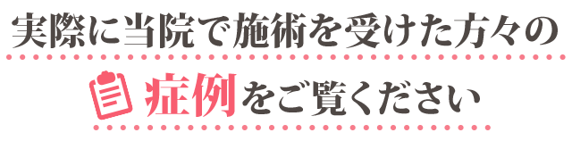 坐骨神経痛