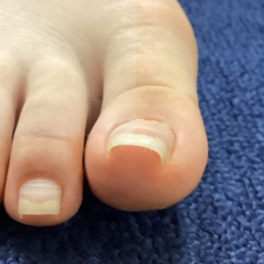 before画像