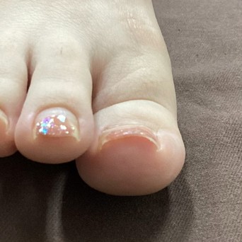 before画像