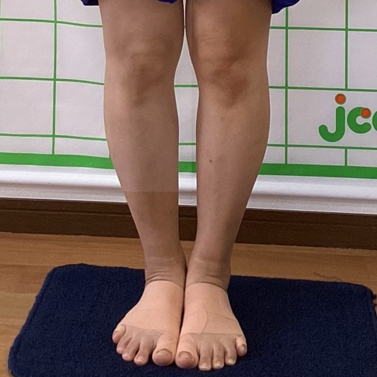 after画像