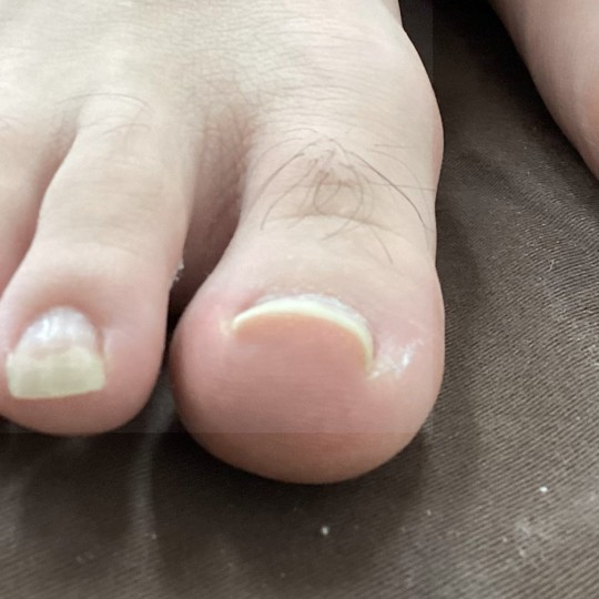 before画像