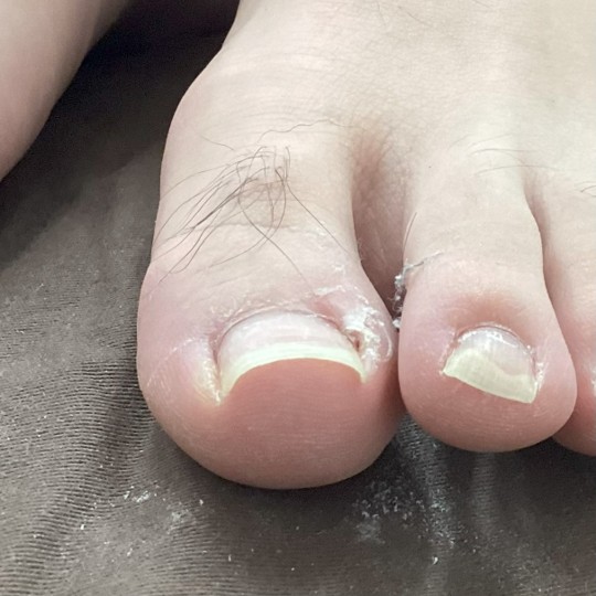 before画像